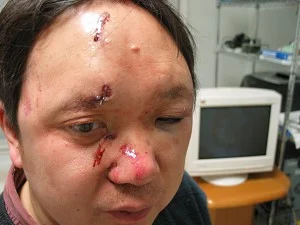 CTO do Epoch Times ferido após ataque por homens não identificados em sua casa nos EUA, 2006